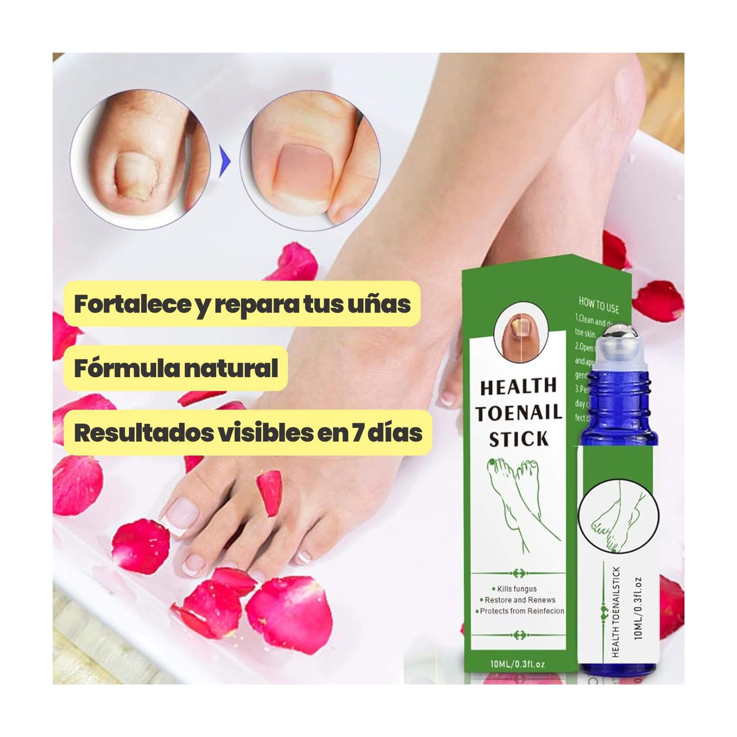 Tónico Antihongos para Uñas